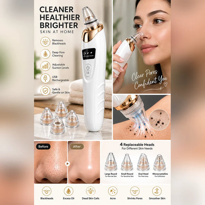 3-in-1  Electric Blackhead Remover & Facial Pore Vacuum Cleaner